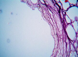 Pourquoi les courbatures apparaissent-elles après l’effort ? Pourquoi les courbatures apparaissent-elles après l’effort ?